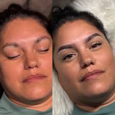 Brow lamination with thuya system and bronsun dye