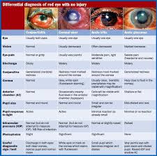 Image result for Acute Red Eye