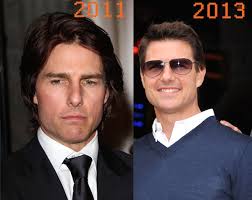 Here's what i've learned since my first cosmetic procedure 25 years ago. Is Tom Cruise Opting For Plastic Surgery Cosmetic Town