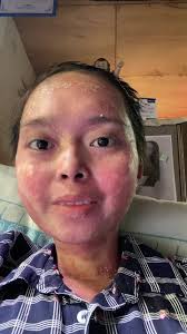 Isli Jane Tojong (@itsmeisli_at_ig)