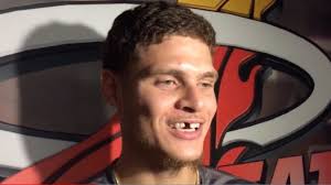 Jun 29, 2021 · he, khris middleton and jrue holiday had more turnovers (nine) in the half than field goals (eight). Tyler Johnson Explains Why He Won T Replace Missing Tooth From Last Season