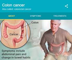 Learn the symptoms and treatment for stomach cancer from webmd and find out how you can lower your risk. Colon Cancer Polyps The Main Precursors Best Hindi Shayari Love Quotes Sms Messages For Love Sad Flirting And Cheating