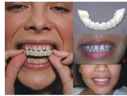 Hey guys! Is there an app or something where I can upload a picture and see  what I would look like with good teeth?