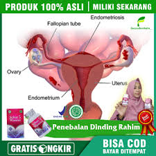 Maybe you would like to learn more about one of these? Obat Herbal Penebalan Dinding Rahim Hyperplasia Endometrium Penebalan Dinding Rahim 2 Cm Pendarahan Hebat Walatra Sehat Wanita 100 Original Produk Lazada Indonesia