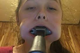 Teen girl accepts a dare to put a hammer in her mouth