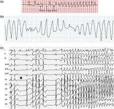 Image result for U Wave