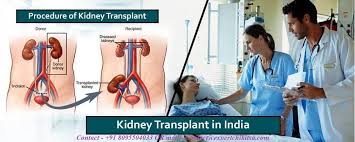 Kidney Transplant In India
