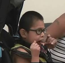 Medical Considerations for Adults with Intellectual and Developmental  Disabilities