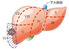 肝臓の病気 日本消化器外科学会