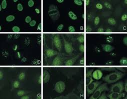 Autoantikorpernachweis Mittels Indirekter Immunfluoreszenz An Hep 2 Zellen Pdf Free Download