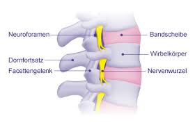 Neuroforamen Gelenk Klinik De