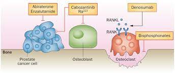 25.02.2011 · zoledronic acid was the first approved agent for retarding skeletal events in men with metastatic prostate cancer, on the basis of the phase 3 trial 2 showing that it was superior to placebo. Managing Bone Metastases And Reducing Skeletal Related Events In Prostate Cancer Nature Reviews Clinical Oncology