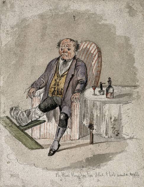 Gout: The Disease of Kings – Drawing Blood
