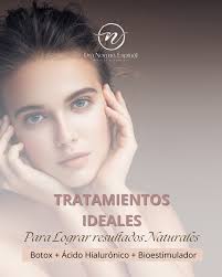 La belleza está en el ojo de quien la mire, sin embargo existen  proporciones, volúmenes y calidad de la piel que le suman belleza al  rostro. En este caso le realicé a