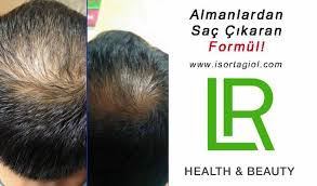 Almanlardan Sac Cikaran Formul Almanlardan Sac Cikaran Etkin Formul S Almanlardan Cikaran Etkin Formul Sac Sacbakimi Sacbakimid Sac Aloe Genetik