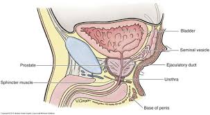 Nearly all prostate cancer is derived from the glandular epithelium of the prostate: Abd Chap 23 24 Prostate Scrotum Nh Flashcards Quizlet