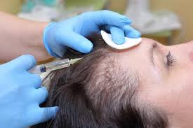 What Does It Mean If You Have Hair Loss On One Side Of Your Head Lovetoknow