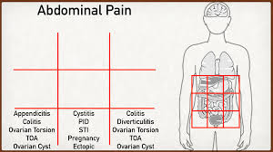 By thinking in anatomic terms, you will remind . Abdominal Pain Causes And Anatomy Right Vs Left Male Vs Female Lower Stomach Quadrants Ezmed