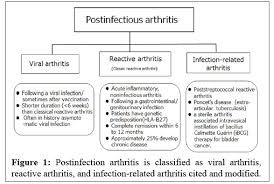 Image result for Poststreptococcal Reactive Arthritis