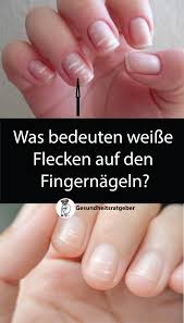 Dieses phänomen wird leukitschia genannt und ist sehr leicht zu behandeln. Was Bedeuten Weisse Flecken Auf Den Fingernageln Tipps Und Tricks Tipps Tricks