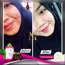 Jerawat semakin pulih selepas menggunakan mylea freckles serum. 10 Zuif X Mylea Freckles Serum Ideas Freckles Serum Shades Of Yellow Color
