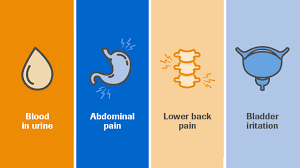 Since bladder cancer that is detected in the early stages has a good chance of cure, awareness of the. Roche Understanding The Impact Of Bladder Cancer