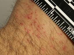 We would like to show you a description here but the site won't allow us. De Wereld Van Insecten Weet Wat Je Beet