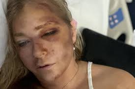 Virginia Giuffre was a vocal advocate for sexual abuse victims