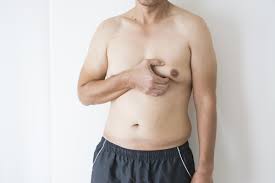 The primary symptom of gynecomastia is enlargement of the male breasts. Gynecomastia Or Male Breast Treatment Dubai General Surgery Clinic
