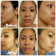 If you know me, you know I use Essential Oils, because I was super sick for  a long time. I'm super concerned about ingredients, and making sure I'm not  using products that