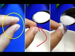 راح عمرنا واحنا نقشر الجلد بسكين الملح يزيل غراء السوبر جلو Youtube