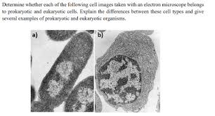 We did not find results for: How To Tell If A Cell Is Prokaryotic Or Eukaryotic Under A Microscope
