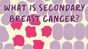 If you are in otherwise good health, you might want to think about taking part in a clinical trial testing a newer treatment. Secondary Breast Cancer In The Bone