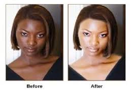 Black And White Bleaching Cream Before And After Pin On My Saves