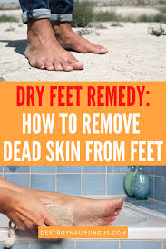 As seen, dead skin on your feet may be caused by underlying medical conditions. How Do You Get Dead Skin Off Feet And Keep Them Supple
