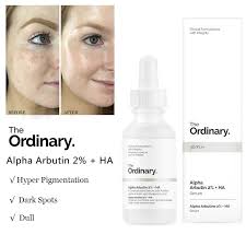Eye serums product type eye serums is not selectable. The Ordinary Alpha Arbutin 2 Ha 30ml Remove Dark Spots Freckle Hyper Pigmentation Whitening Face Serum Shopee Malaysia