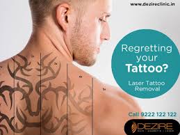 As science is progressing, tattoo removal has gained immense popularity. Is The Tattoo Removal Painful Quora