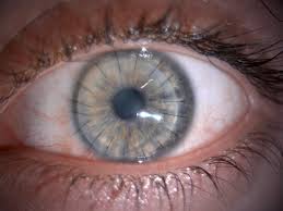 So that could be relatively narrow cuts on your hand or near a joint, or wide and deep cuts on an arm or leg. The Seventeen Stitches Left In My Eye While It Recovers From Corneal Transplant Surgery Mildlyinteresting