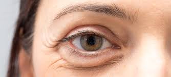 Unfortunately, however, these unwanted side effects can go on for hours. Bags Under Eyes Symptoms And How To Get Rid Of