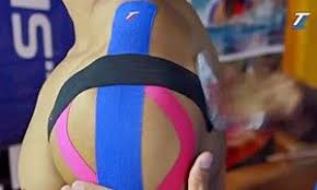 Como Colocar La Cinta Kinesiologica Target Tape Hombro Congelado Vendaje Neuromuscular Kinesiologia
