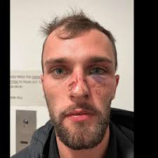 Gay Man Says Security Guards Savagely Beat Him at Popular Nightclub