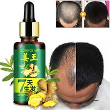 Fenugreek may have a long history in many countries all over the world. Fheaven Natural Hair Growth Essence Liquid Fast Hair Growth Treatment Hair Loss Buy Online In Angola At Angola Desertcart Com Productid 67496324
