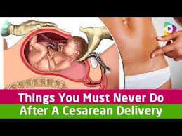 Safe Exercises After A Cesarean 2 4 Weeks Post Op Full Video Youtube Cesarean Delivery Baby Workout Cesarean