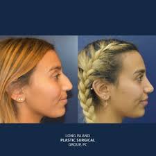 Brian A. Pinsky, Md, Facs, пластическая хирургия, Вирджиния, округ Роанок,  улица Вест Мейн — Яндекс Карты