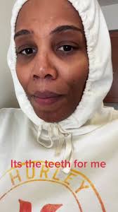 Laughing at Coworkers' Teeth: A Funny Comedy Joke from Chicago