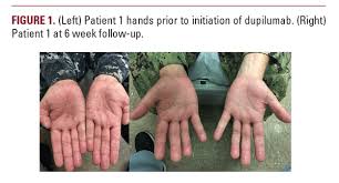 Article Jddonline Journal Of Drugs In Dermatology