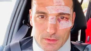 El lado desconocido de Scaloni