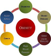 Pin On Obesity