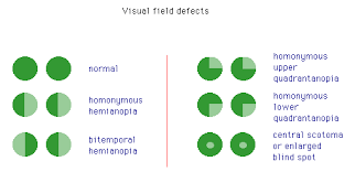 Defect Diagram Schematics Online
