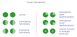 defect diagram schematics online